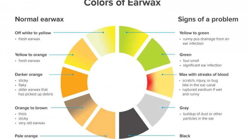 ear wax colour meaning